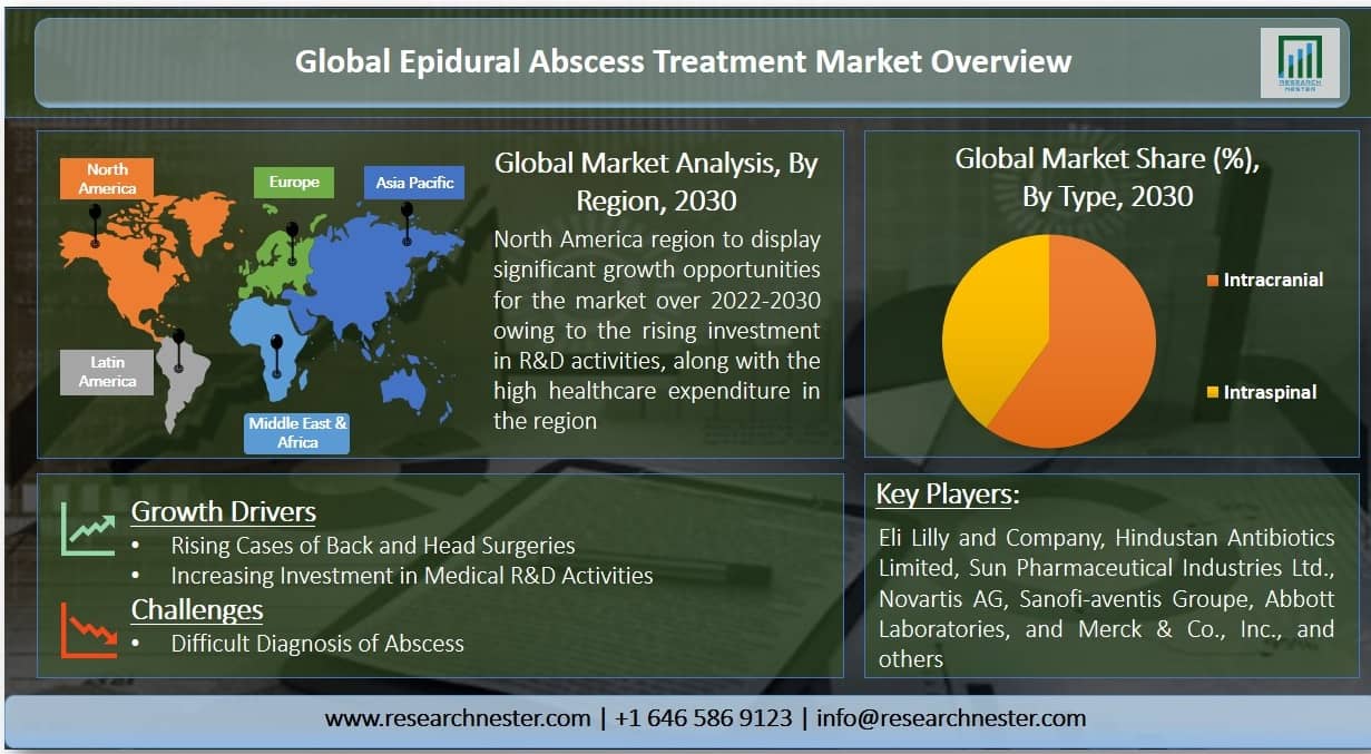 硬膜外膿瘍治療市場グラフ
